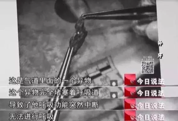 他只有3歲,只因補一顆牙,竟莫名身 亡!!驗屍結果令人震驚。。。。