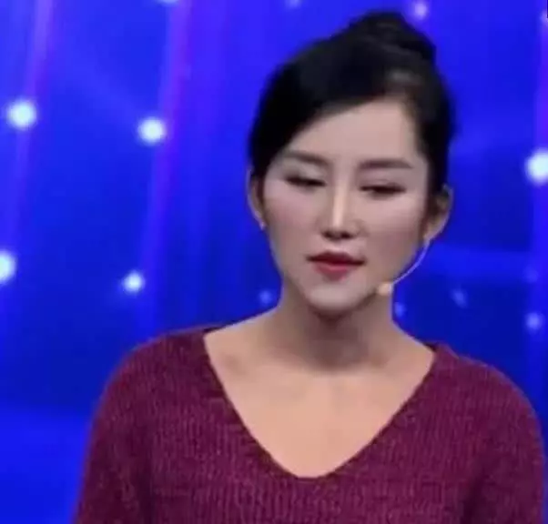 女子整容12次無一成功,摘下面具的那一刻,卻讓網友呆了!