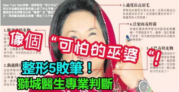 她看來像個「可怕的巫婆「!獅城醫生專業判斷!毒舌分析羅斯瑪整形5敗筆!