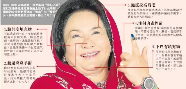 她看來像個「可怕的巫婆「!獅城醫生專業判斷!毒舌分析羅斯瑪整形5敗筆!
