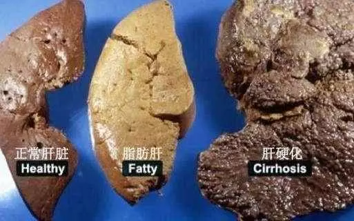 只需連喝4天,肝臟大部分毒素全排光!轉發一次,救人無數!