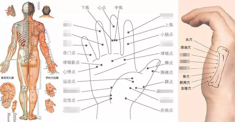 頭痛、喉嚨痛、閃到腰、改善更年期狀態等,常見病痛的穴位按摩大全,收藏起來