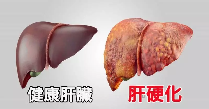 原來馬鈴薯+紅蘿蔔+蘋果 打成汁來喝 竟然有那麼多功效