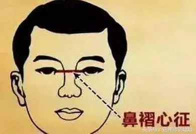 怎樣才能知道你心臟好不好,從這三個地方就可以看出來了