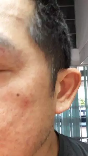 巴士車站載客 ,Grab Car 司機被德士司機打!