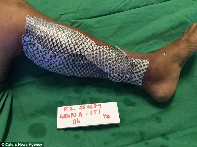 她被烈火圍繞全身...卻靠著一條「吳郭魚」重獲新生 撕下來那一刻還變得更美了!