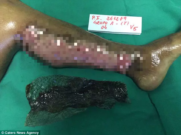 她被烈火圍繞全身...卻靠著一條「吳郭魚」重獲新生 撕下來那一刻還變得更美了!