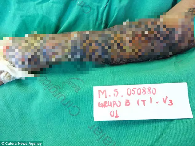 她被烈火圍繞全身...卻靠著一條「吳郭魚」重獲新生 撕下來那一刻還變得更美了!