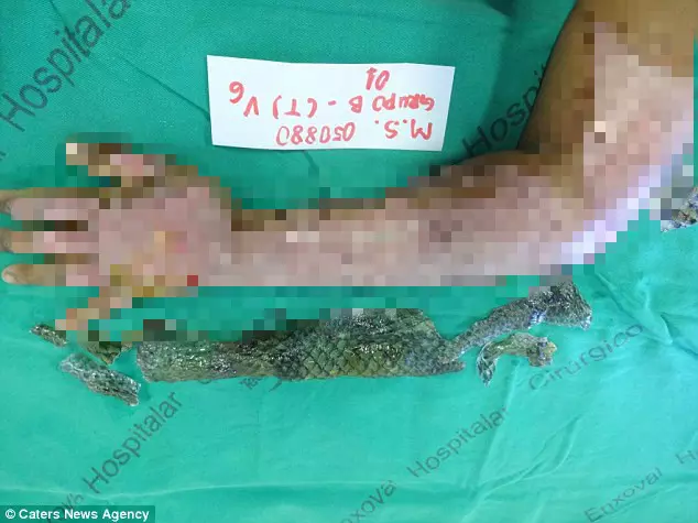 她被烈火圍繞全身...卻靠著一條「吳郭魚」重獲新生 撕下來那一刻還變得更美了!