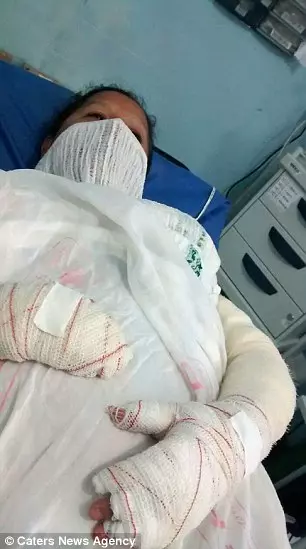 她被烈火圍繞全身...卻靠著一條「吳郭魚」重獲新生 撕下來那一刻還變得更美了!