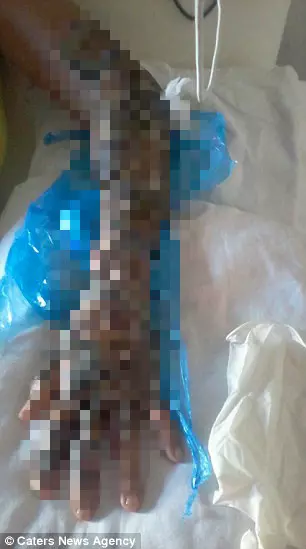 她被烈火圍繞全身...卻靠著一條「吳郭魚」重獲新生 撕下來那一刻還變得更美了!