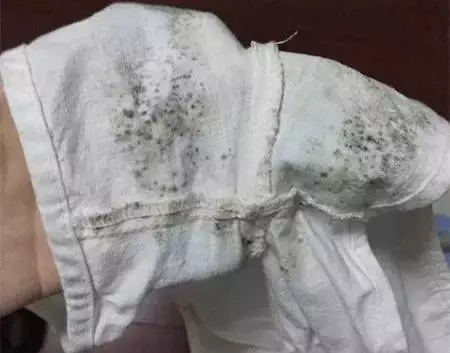 衣服發霉了怎麼洗掉? 6招小妙招 除掉了霉點