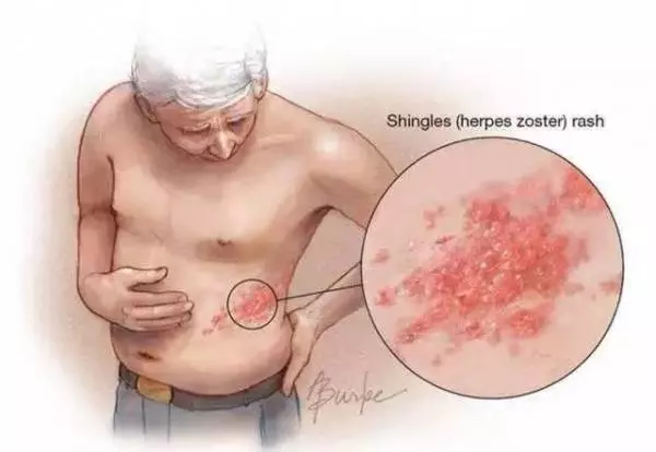 生蛇生到蛇纏腰,奶奶用一種野草泡水搞定了!