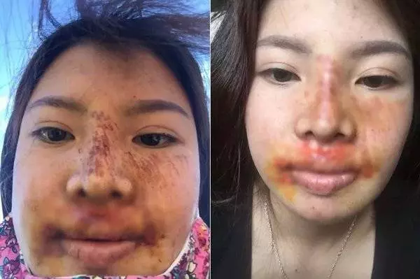 整得了容-改不了運-人工美女摔一跤打回原形