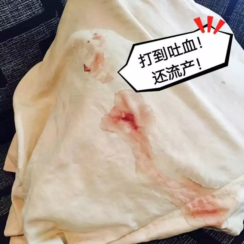 近日來大馬又出現一個渣男打女人, 打到吐血還流產 ! 太過分了!!