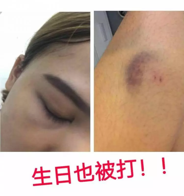 近日來大馬又出現一個渣男打女人, 打到吐血還流產 ! 太過分了!!