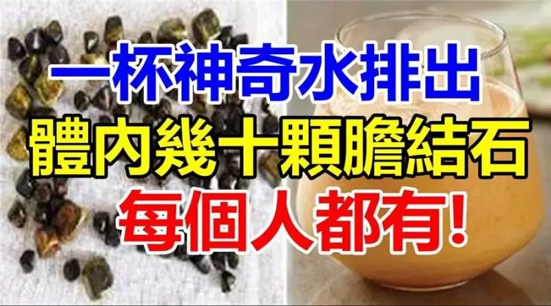 7天內能排出體內幾十顆「膽結石」!每個人都有!嘗試後整個人神清氣爽!