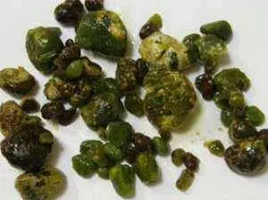 7天內能排出體內幾十顆「膽結石」!每個人都有!嘗試後整個人神清氣爽!