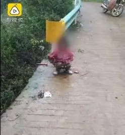 8歲女遭8狗圍攻亂咬 左眼拔出狗牙