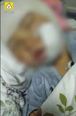 8歲女遭8狗圍攻亂咬 左眼拔出狗牙