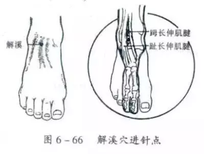 [每日一穴：解溪穴]