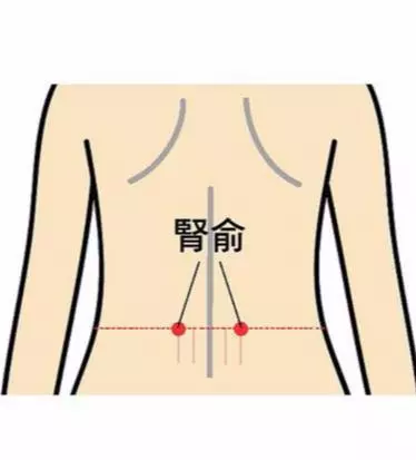 坐骨神經痛、便秘、經痛按這邊!中醫說:7個緩腰痛穴位