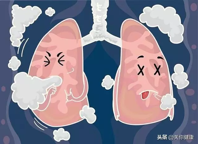 痰排不淨憋死人!醫生提醒:學會5種排痰法,嗓子輕鬆肺乾淨