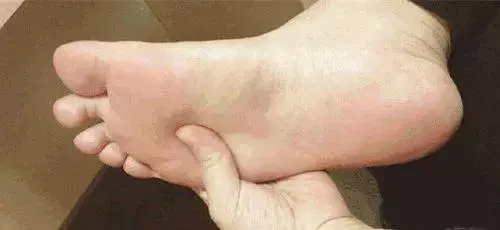 快看看自己的腳,有這三個特徵的注意了!你可能比其他人…