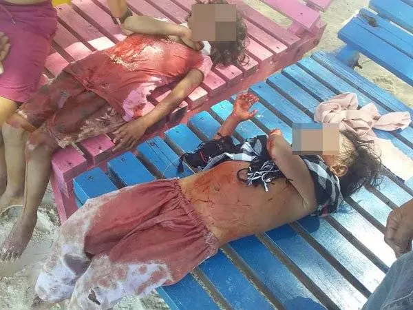 婦女憂鬱症發作,持刀連割4名兒女頸項後,再割喉自殺,釀1死4傷慘劇!