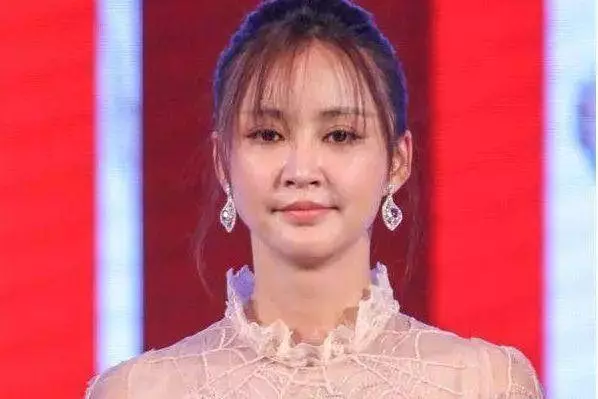 被玻尿酸毀掉的女星,鄭裕玲模樣猙獰,周迅的臉像泡發的饅頭!