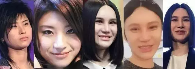 被玻尿酸毀掉的女星,鄭裕玲模樣猙獰,周迅的臉像泡發的饅頭!