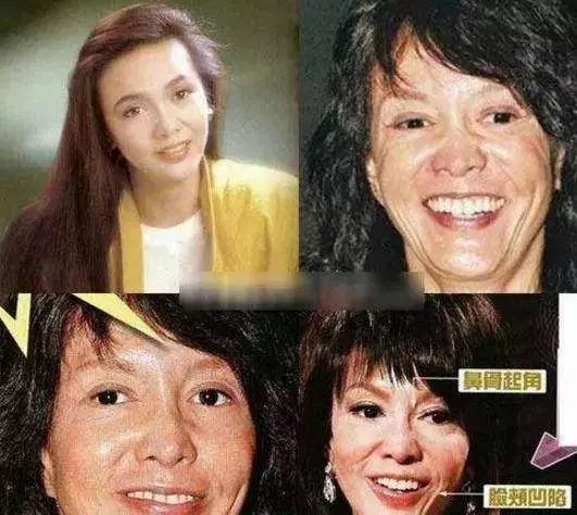 被玻尿酸毀掉的女星,鄭裕玲模樣猙獰,周迅的臉像泡發的饅頭!