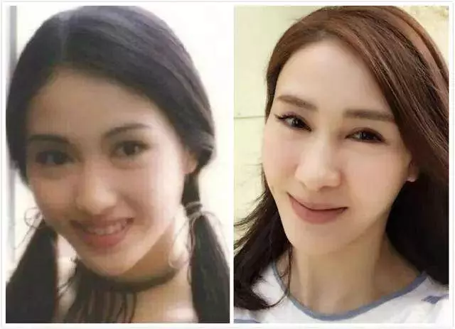 被玻尿酸毀掉的女星,鄭裕玲模樣猙獰,周迅的臉像泡發的饅頭!