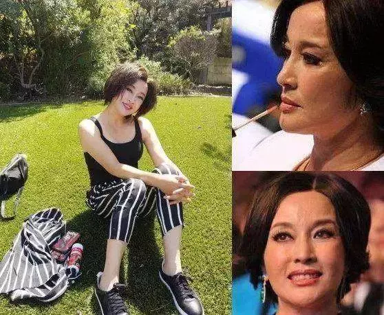 被玻尿酸毀掉的女星,鄭裕玲模樣猙獰,周迅的臉像泡發的饅頭!
