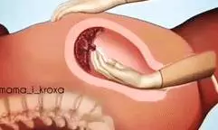 生孩子的疼算什麼?更痛的是刮胎盤的疼!疼到我想放棄生命!看過這組動圖你就明白了!!