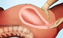 生孩子的疼算什麼?更痛的是刮胎盤的疼!疼到我想放棄生命!看過這組動圖你就明白了!!