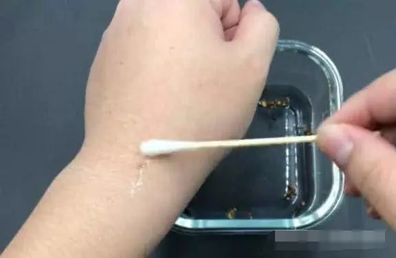 花椒加上大蒜,效果居然這麼好,活了20多年才知道,看完趕緊試試
