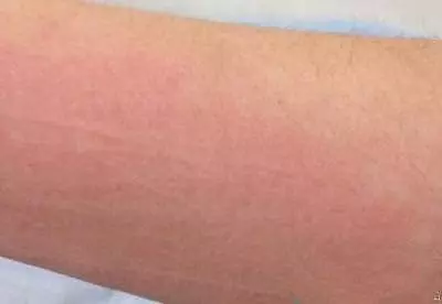 睡覺時有這種表現,多半是【中風】的前兆,一定要警惕!