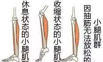 半夜小腿「突然抽筋」,你還在傻傻地以為是缺鈣嗎?可醫生卻說還有這幾種情況