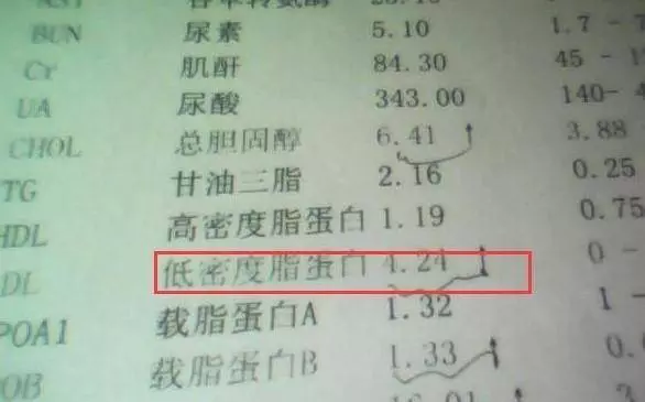 頭部會出現3種情況,常喝1種水,打通血管遠離腦梗