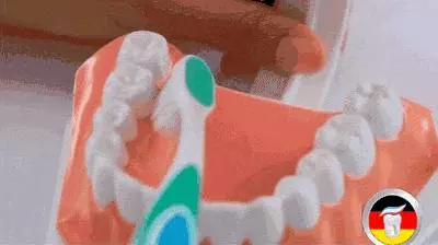 幼兒保健|為什麼我不愛吃糖也有蛀牙?怎麼才能有效的預防蛀牙