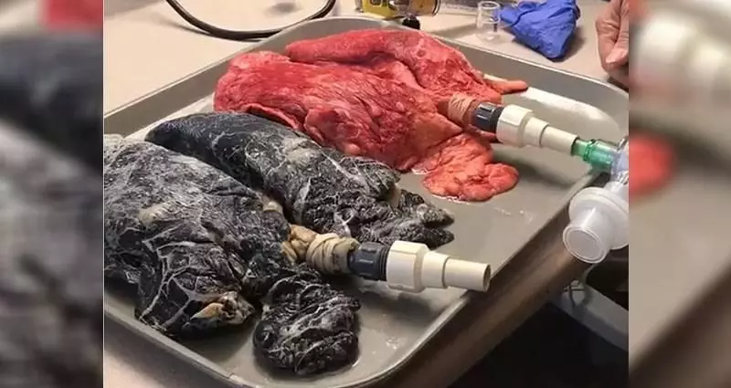 影/她把20年老菸槍的肺跟健康的肺接上呼吸管,驚悚結果把人徹底嚇尿..