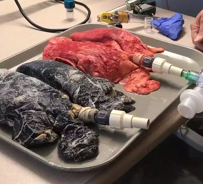 影/她把20年老菸槍的肺跟健康的肺接上呼吸管,驚悚結果把人徹底嚇尿..
