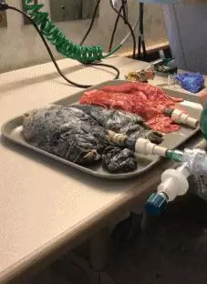 影/她把20年老菸槍的肺跟健康的肺接上呼吸管,驚悚結果把人徹底嚇尿..