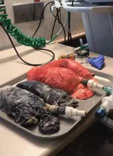 影/她把20年老菸槍的肺跟健康的肺接上呼吸管,驚悚結果把人徹底嚇尿..