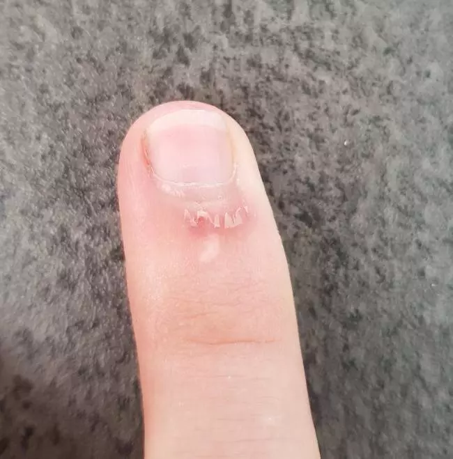 6張會讓你無法忍受「全身癢到想抓抓」的超不舒服照片。「海綿寶寶」體內原來