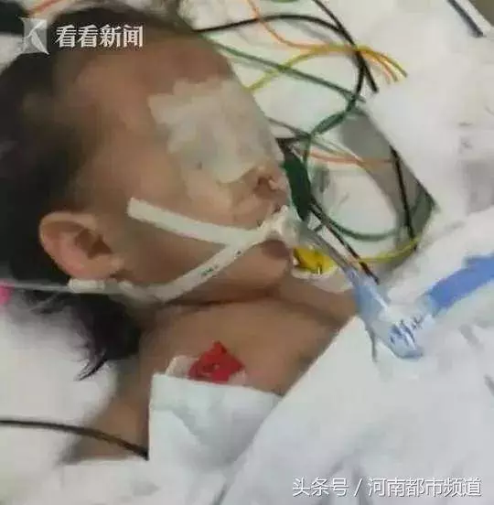 心痛!1歲女童疑遭母親男友虐待,生還可能為零!嫌疑人被刑拘!