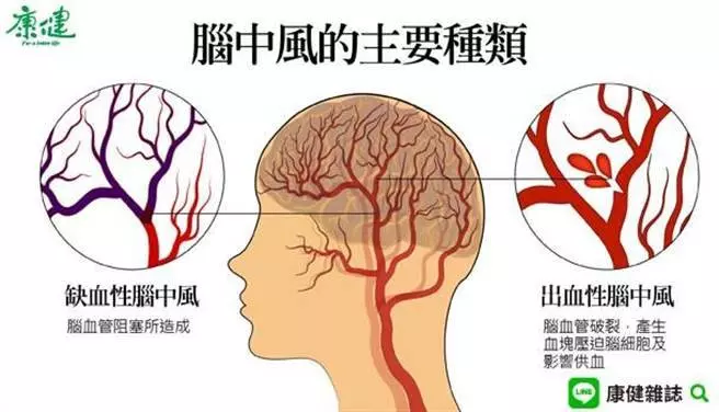 經常手麻怎麼回事?醫生:可能是這3種病的徵兆,莫忽視!