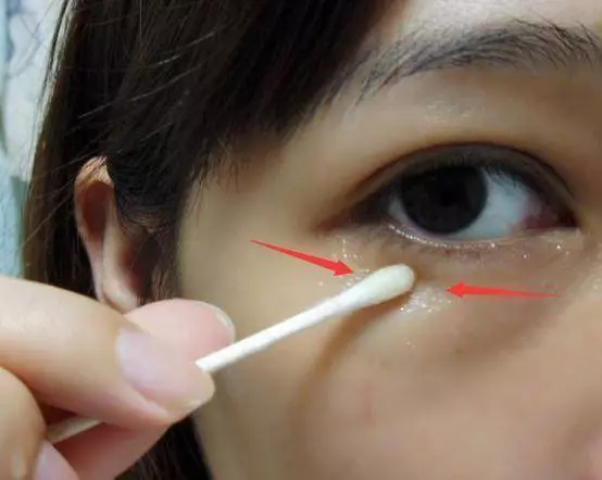 女人長眼袋顯老又難看?抹點廚房便宜貨,不出半月撫平眼袋顯年輕