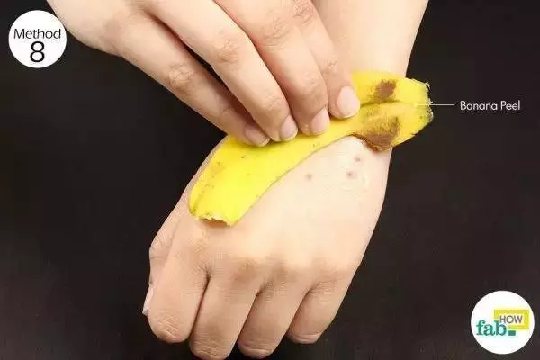 被蚊子咬了又癢又難受教你簡單一招,不用藥,1分鐘快速止癢